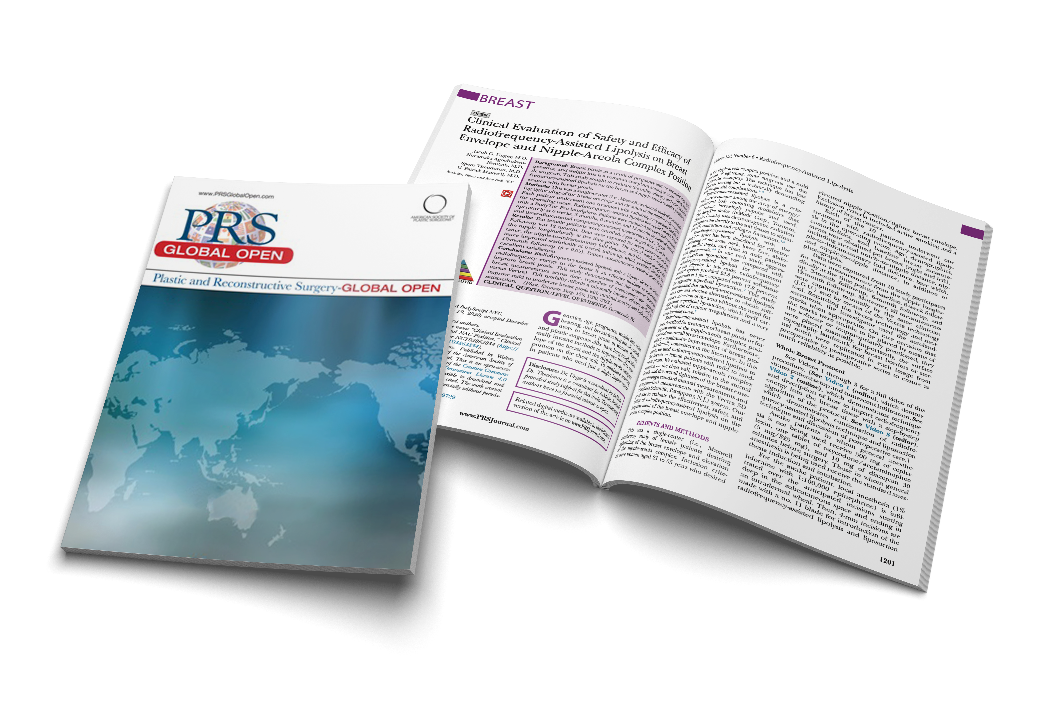 Clinical Evaluation of Safety and Efficacy of RFAL on Breast Envelope ...